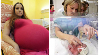 Vác bụng bầu đi khám, mẹ bầu tưởng sinh đôi hóa ra “kỳ tích” 48 năm mới có 1 lần đã xuất hiện