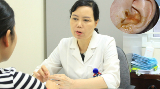 Cách chăm sóc trẻ viêm tai giữa, tránh biến chứng lên não mẹ nào cũng cần