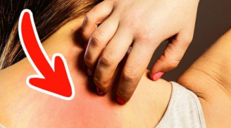 5 thay đổi trên da ''tố cáo'' cơ thể mắc bệnh nguy hiểm, chớ để lâu kẻo hối hận không kịp