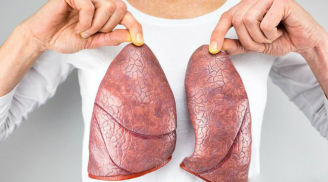Phổi chứa đầy độc tố: 4 việc cần làm ngay nếu muốn phổi khoẻ mạnh, lọc sạch bay mọi chất độc