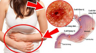 Cảnh báo từ vụ: Cãi nhau dữ dội với chồng, sau một đêm không ngủ vợ trẻ nôn ra máu phải cấp cứu