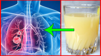6 thực phẩm 'độc' chẳng kém gì thuốc lá, gây nguy hại cho phổi, chớ dại mà nạp vào người