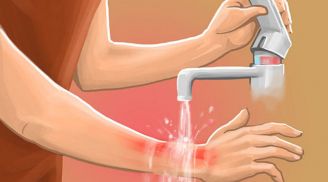 Bé 4 tuổi bị bỏng, cách xử lý nhanh trí của bà nội để cứu cháu khiến bác sĩ phải khen