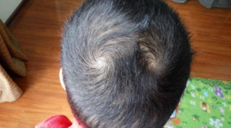 Đàn ông sở hữu nét quý tướng sau trung vận sẽ chuyển mình giàu có, nhưng lại mắc tật trăng hoa đa tình