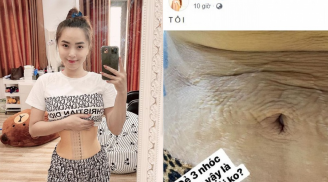Hải Băng hé lộ hình ảnh bụng chằng chịt vết rạn sau 3 lần sinh con, bà mẹ nào cũng thấy đồng cảm