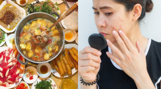 Sau khi ăn đồ cay nóng, làm ngay 4 việc để giải nhiệt cơ thể, tránh nổi mụn nhọt