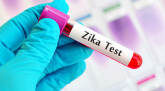 Việt Nam vừa ghi nhận 1 trường hợp mắc bệnh do virus Zika gây bệnh đầu nhỏ