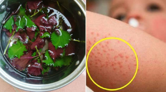 5 loại lá tắm trị rôm sảy thường được dùng trong mùa hè
