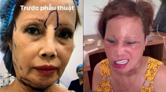 'Cô dâu 62 tuổi' ở Cao Bằng xuất hiện với gương mặt 'biến dạng' không thể nhận ra