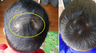 Nhìn xoáy tóc của trẻ biết vận mệnh tương lai, con bạn có mấy xoáy?