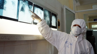 Ca bệnh Covid-19 thứ 416 khó cai ECMO, tiên lượng nặng