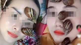 Bắt ốc sên ngoài vườn dưỡng da, lợi đâu không thấy chỉ thêm “rước họa vào thân”