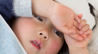 Những điều cần lưu ý khi bị sốt xuất huyết