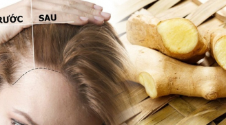 Nối tóc chỉ thêm nặng đầu, chi bằng học lỏm 5 cách cực hay vừa kích thích tóc mọc nhanh lại an toàn