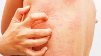 Bỗng thấy ngứa 7 vị trí này trên cơ thể, hãy đi khám ngay vì nó cảnh báo bạn đang mắc bệnh nguy hiểm