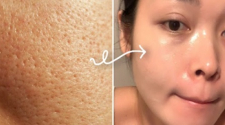 5 mẹo thu nhỏ lỗ chân lông cho làn da lão hóa, không tốn kém mà vẫn hiệu quả tức thì