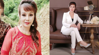 Hình ảnh mới nhất của 'cô dâu 62 tuổi' sau hơn 1 tháng điều trị méo miệng vì phẫu thuật thẩm mỹ hỏng