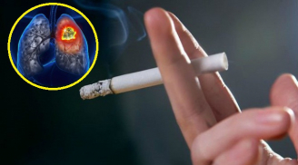 Chồng hút thuốc 20 năm, vợ bị ung thư phổi: Cảnh báo 5 thủ phạm gây bệnh luôn có mặt trong mỗi nhà