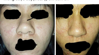 Đang đêm đăng bài nhờ dân mạng tư vấn da, cô gái dọa mọi người một phen đứng tim