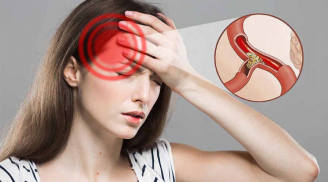 4 dấu hiệu trên mặt cảnh báo não đang thiếu máu mà không phải ai cũng nhận ra