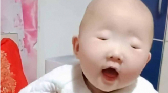Con sinh ra mắt bé tí như hạt đậu xanh, mẹ khóc thét vì xấu, vài tháng sau không ai nhận ra đứa trẻ