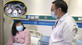 Người phụ nữ ốm suốt 5 năm, đến khi đi khám thận đã chảy mủ: Nguyên nhân do thói quen nhiều người vẫn làm
