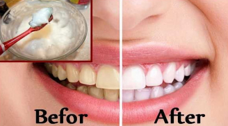 Cầm 20 nghìn đồng ra ngoài chợ mua thứ này về đảm bảo răng bạn sẽ trắng sáng trong vòng 1 nốt nhạc
