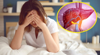Sáng ngủ dậy thấy 4 biểu hiện bất thường: Cảnh báo gan tổn thương nghiêm trọng