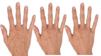 3 mẹo nhanh đơn giản giúp kéo căng từng nếp nhăn giúp bàn tay bạn trẻ đẹp ra đến 7 năm tuổi