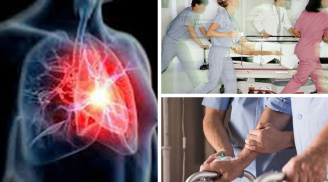 Cô gái 17 tuổi bị đột quỵ, chuyên gia cảnh báo những nguy cơ ở người trẻ