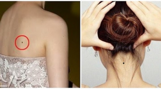 4 vị trí nốt ruồi xấu tới mấy cũng đừng xóa, để đó hưởng phúc đức, tài lộc cả đời