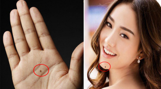 3 nốt ruồi bí mật trên cơ thể ẩn chứa tài lộc, chiêu mộ quý nhân, tiền trăm vào tay sinh ra tiền tỷ