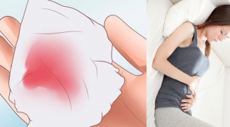 Ra máu đỏ khi mang thai 3 tháng đầu là bị gì?