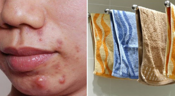 Người Việt có thói quen dùng khăn mặt: Ai ngờ là sai lầm rước vi khuẩn, hỏng da mặt, hãy vứt ngay đi