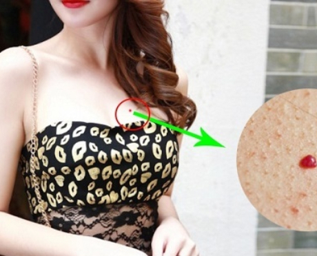 Phụ nữ có nốt ruồi son ở 5 vị trí này báo hiệu cuộc sống sung túc, chồng chiều chuộng hết mực